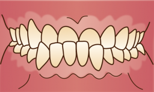 orthodontics035