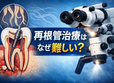 なぜ再根管治療は難しいのか?1回目の根管治療より成功率が下がる理由