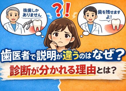 歯医者で説明が違うのはなぜ？｜診断が分かれる本当の理由と正しい判断基準