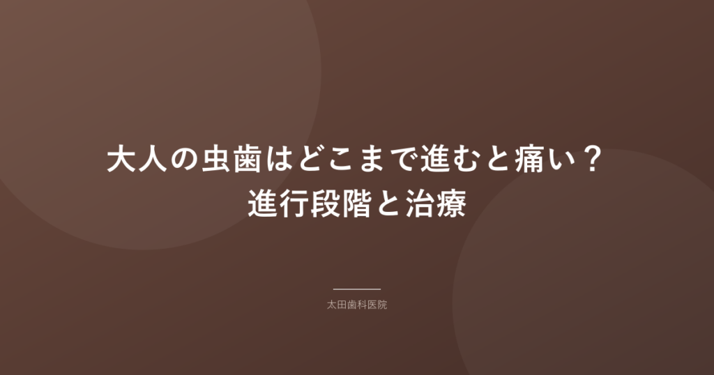 【岡谷市】大人の虫歯はどこまで進むと痛い？進行段階と治療