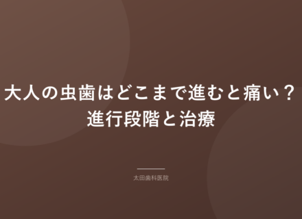 【岡谷市】大人の虫歯はどこまで進むと痛い？進行段階と治療