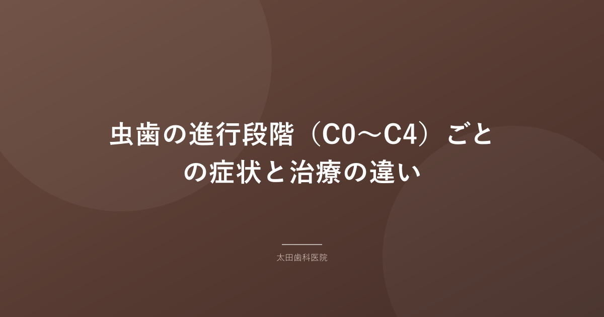 虫歯の進行段階(C0〜C4)ごとの症状と治療の違い