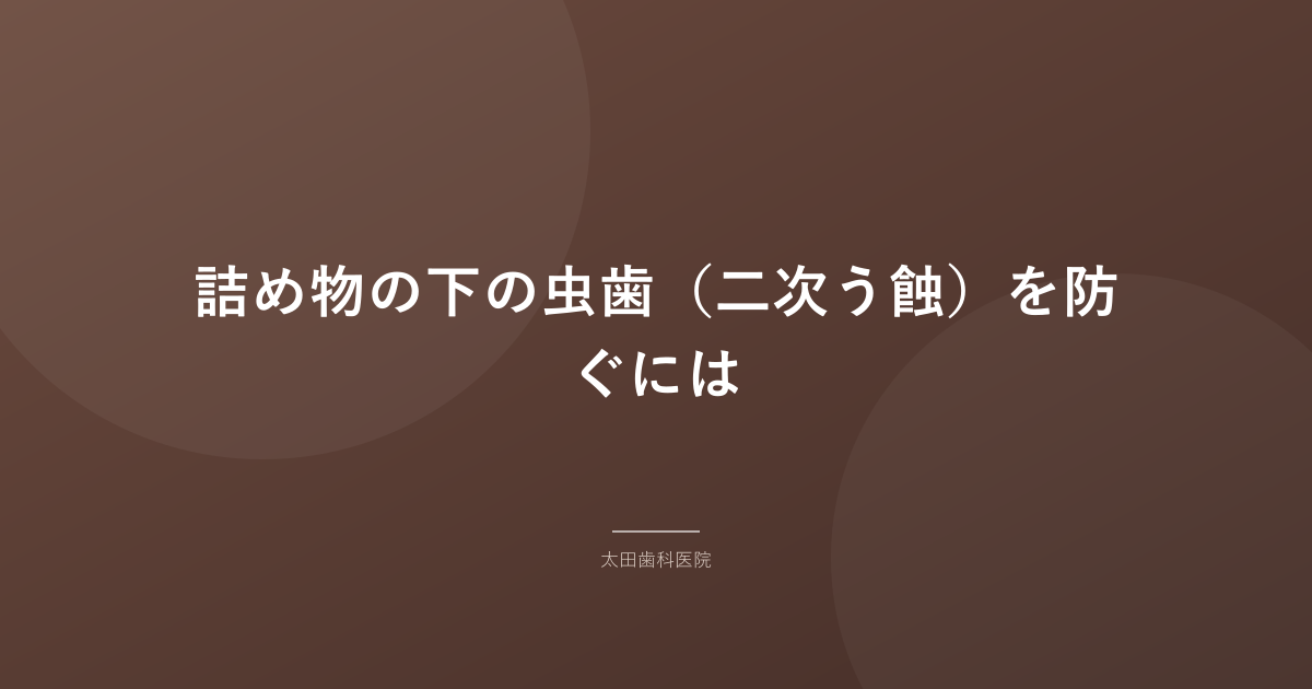 詰め物の下の虫歯(二次う蝕)を防ぐには