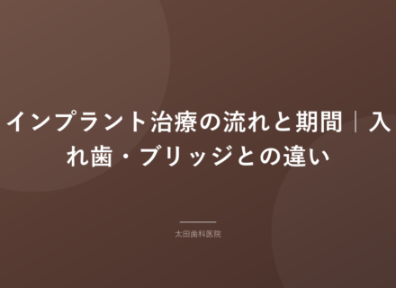 【岡谷市】インプラント治療の流れと期間|入れ歯・ブリッジとの違い